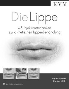 Die Lippe, Buch von Christian Köhler, prevention-center Zürich